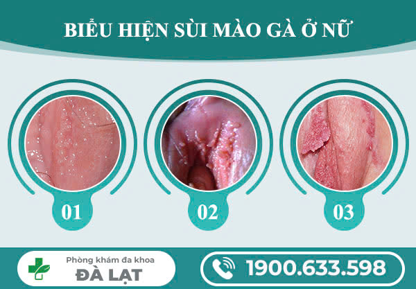 Hình ảnh minh họa